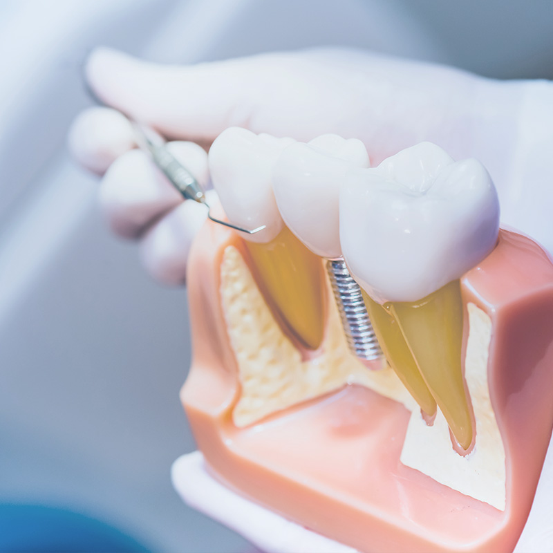 Dental Office in Acton