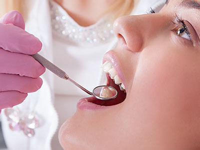 Dental Fillings 01720